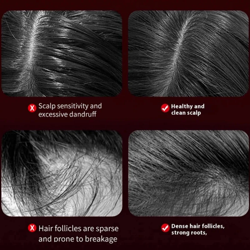 HairGlow Kopfhaut-Massagebürste